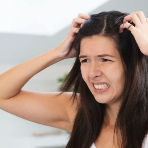 woman itching scalp kanayaa